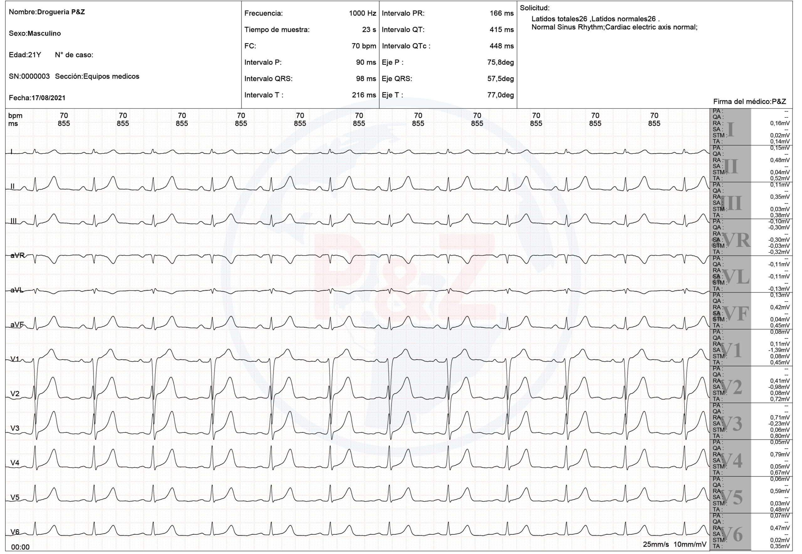 Reporte ecg